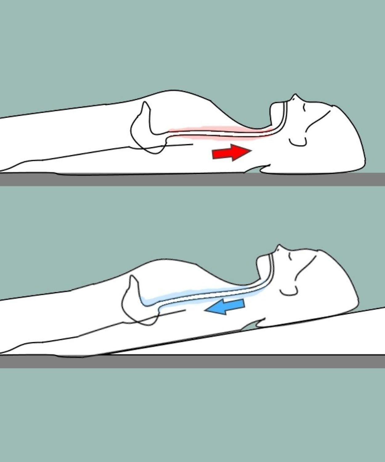 elevate bed for reflux